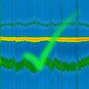 ECG overview