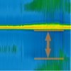 ECG detail