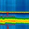 ECG comparison